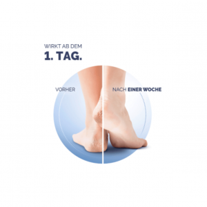 Kem trị nứt gót chân Scholl Schrunden Salbe